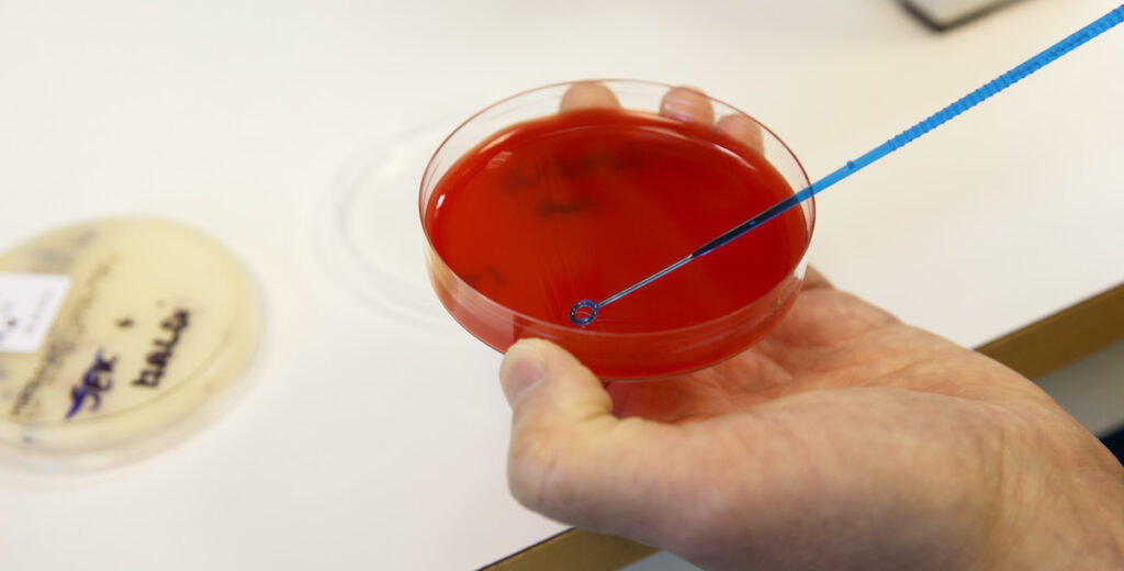 WHO har listat antibiotikaresistens som “ett av de ledande globala hälsohoten” 